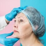 Plastic Surgery Specialist in Delhi